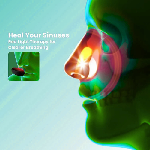 Imperial™ - Comfortable Nasal Solution