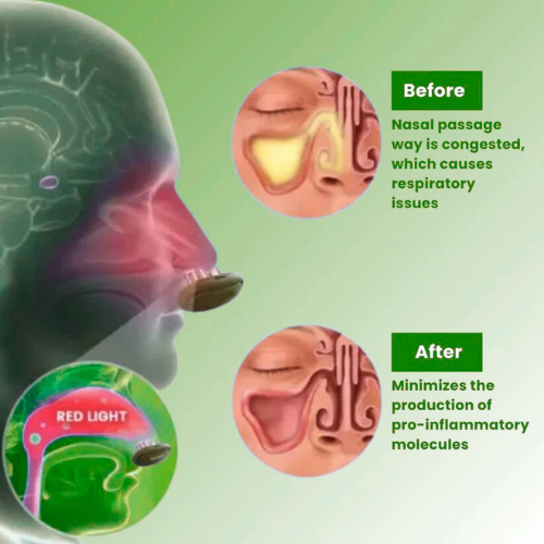 Imperial™ - Comfortable Nasal Solution