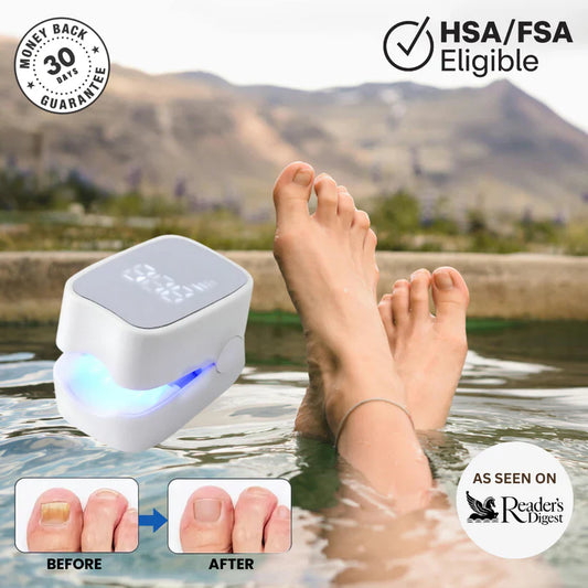 Imperial™ - Nail Fungus Laser Device